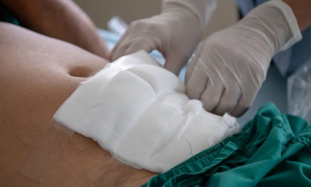 Use of abdominal bandage for large wound dressing