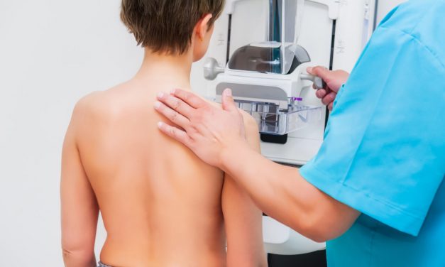 Why You Need Mammography Screening
