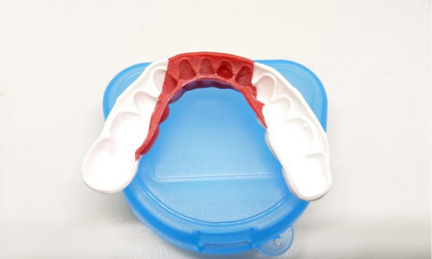 Quick and easy steps on how to mold a mouthguard