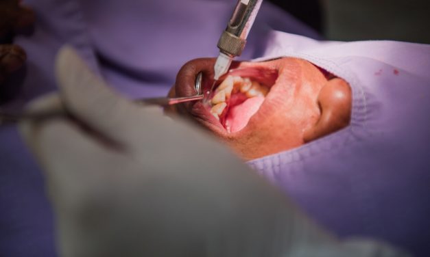 Can A Patient Have Tooth Extraction And Implant At The Same Day?